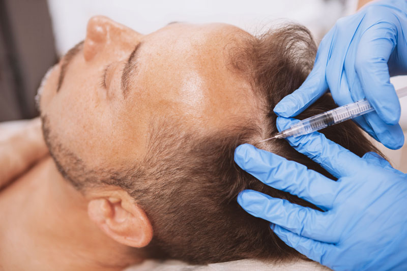 Platelet Rich Plasma (PRP) Therapy In Delhi Platelet Rich Plasma (PRP) Therapy In Delhi